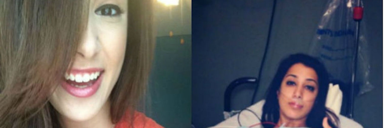 Living With a Chronic Illness and Looking Healthy