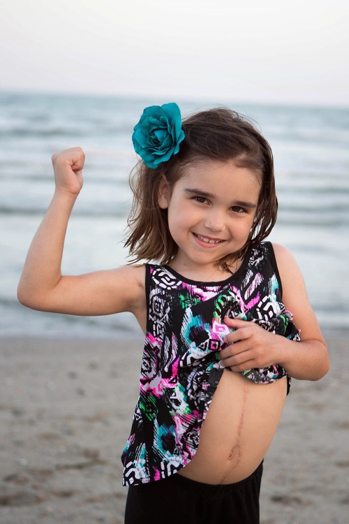 little girl showing off scar at the beach