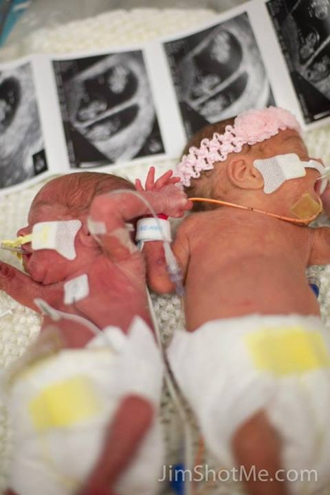 two premature babies in hospital bed