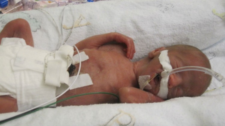 preemie baby in incubator