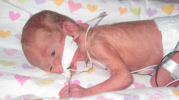 preemie baby in incubator