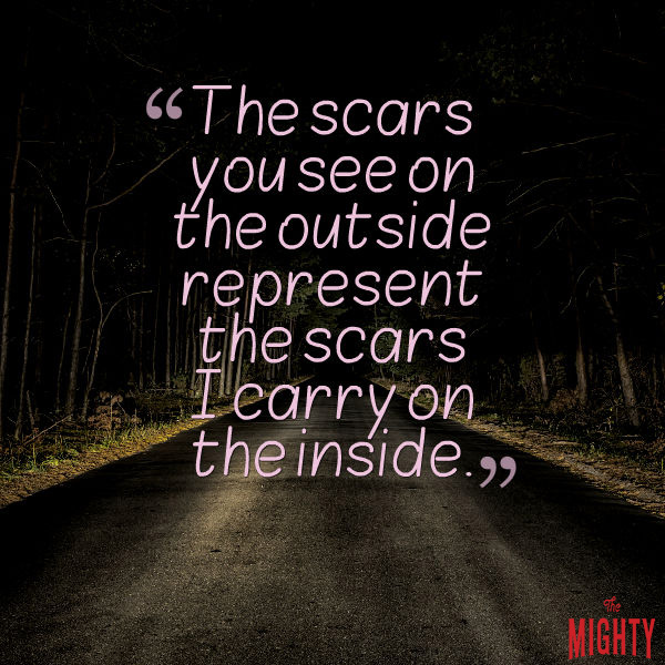 "The scars that you see on the outside represents the scars I carry on the inside.."