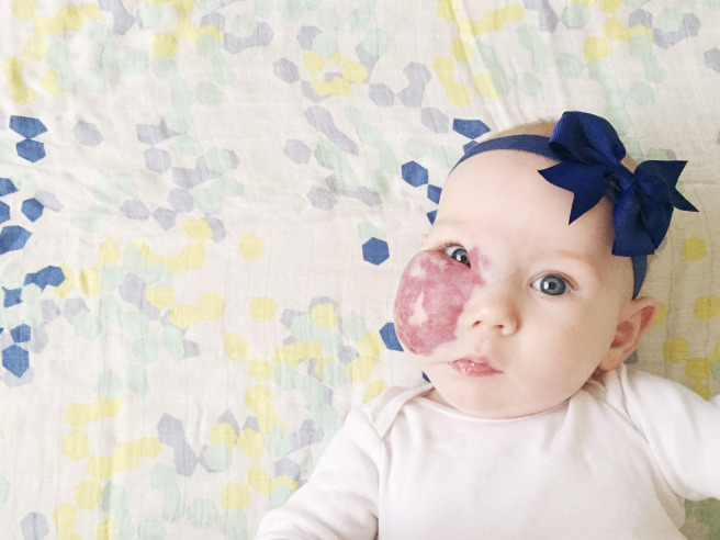 baby wearing blue ribbon bow