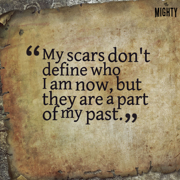 My scars don't define who I am now, but they are a part of my past.