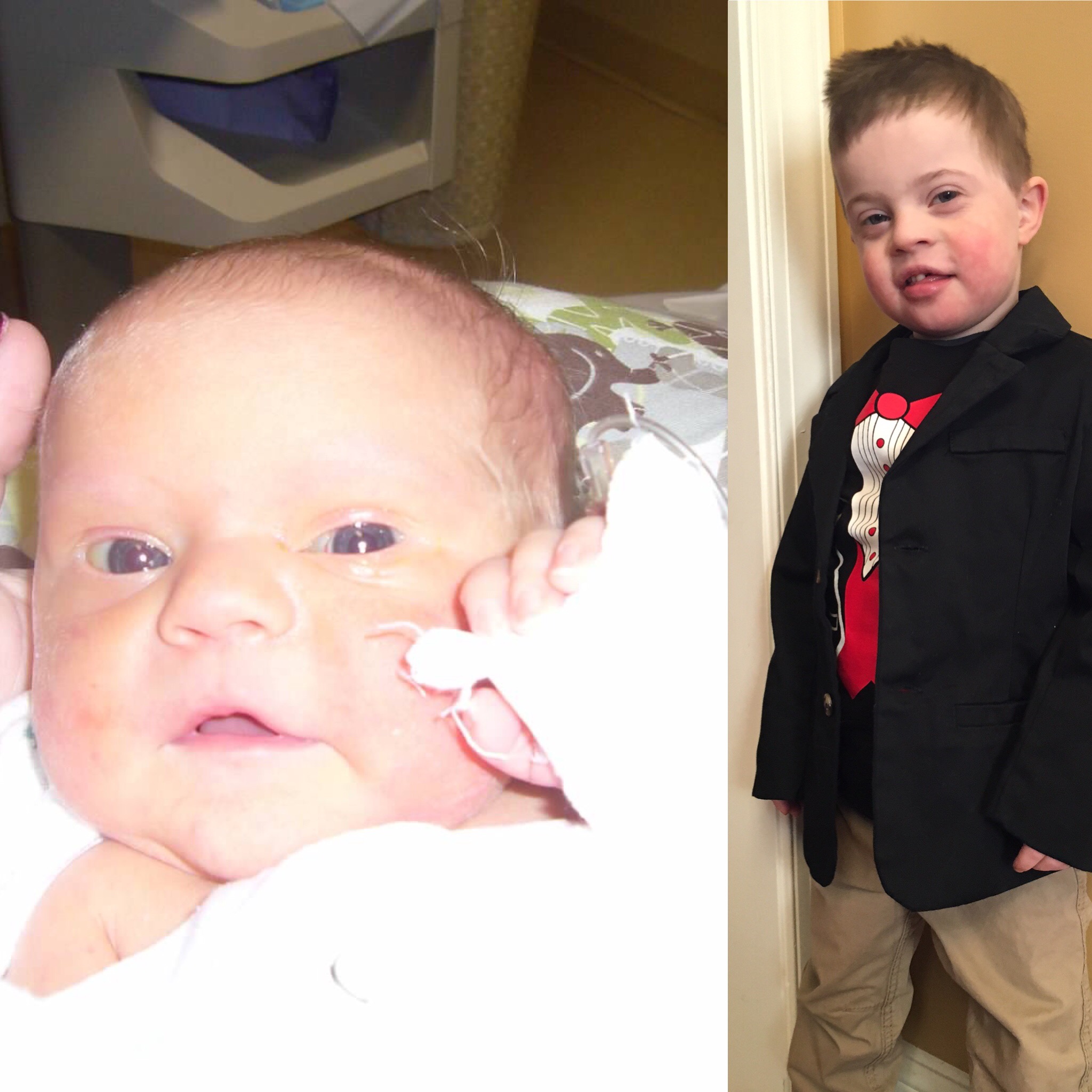 Side by side photos of baby and little boy