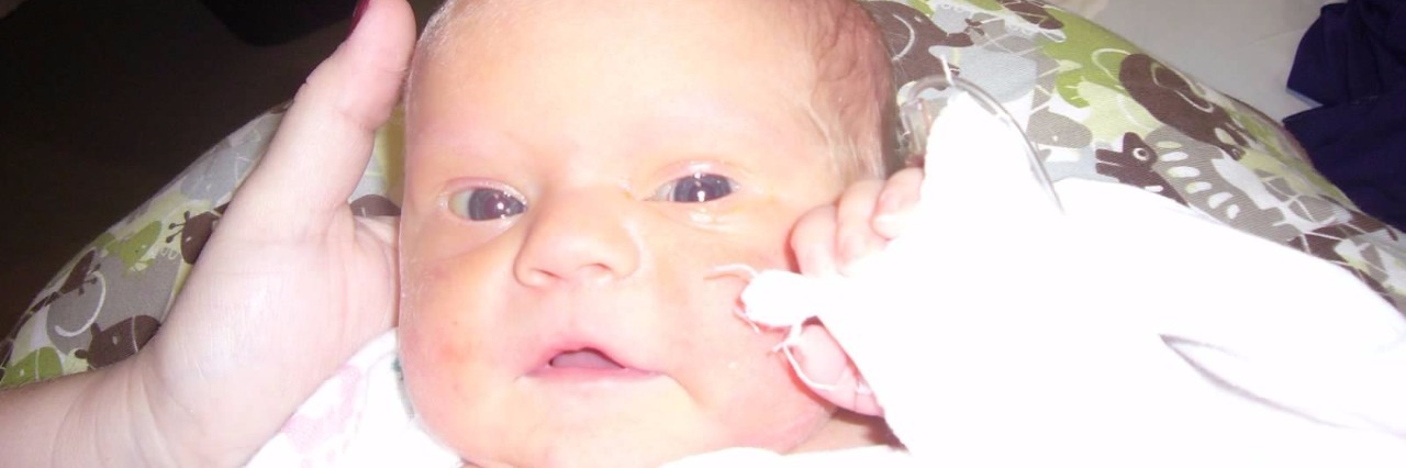 To Med Students Who Will Deliver Down Syndrome Diagnoses Birth photo of baby boy