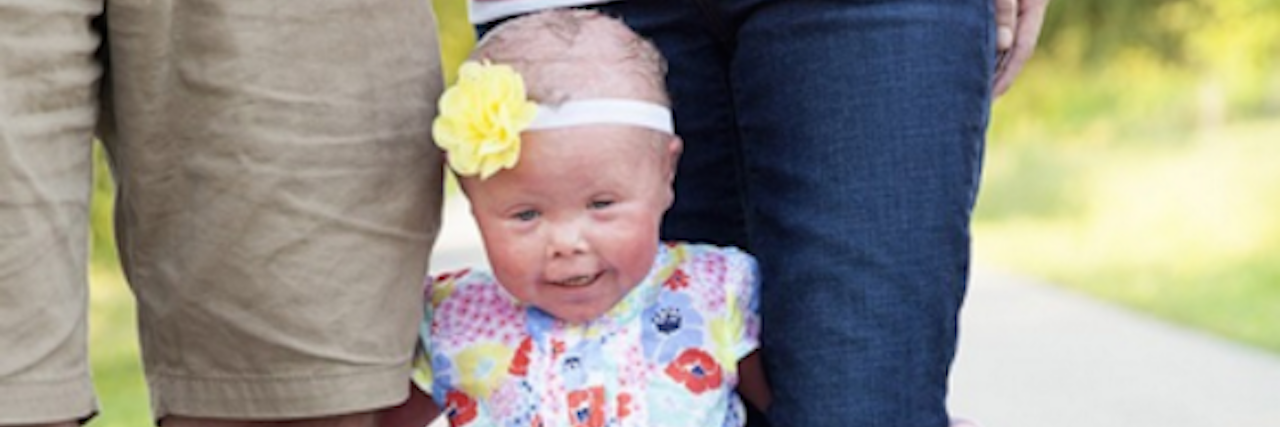 A Child Commented on My Daughter's Skin Condition and She Responded