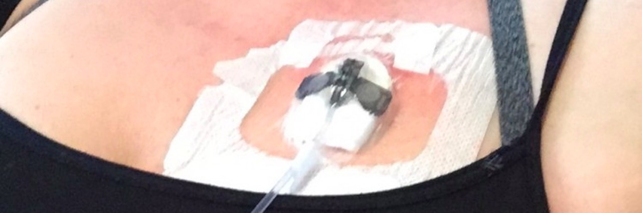 When People Misunderstand Your Invisible Illness a port in a patients chest