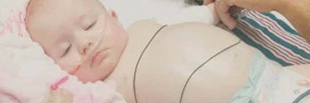 Why It's OK to Feel Sad as the Parent of a Child With Neuroblastoma A baby girl resting in hospital with wires connected to her nose and stomach