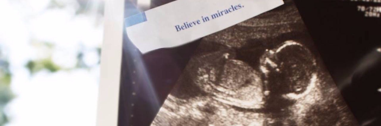 A photo of an ultrasound with the words "Believe in miracles"