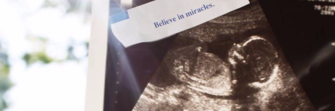 Jessi Snapp Still Believes in Miracles After Her Baby Son Dies A photo of an ultrasound with the words "Believe in miracles"