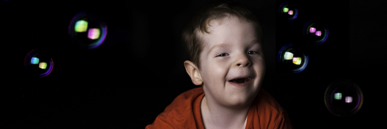 Son With Moebius Syndrome Inspires Mom's Rare Disease Photo Series young child with moebius syndrome