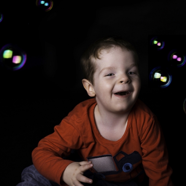 Son With Moebius Syndrome Inspires Mom’s Rare Disease