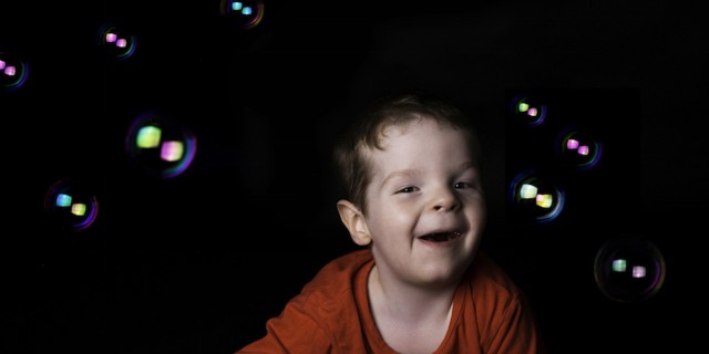 young child with moebius syndrome