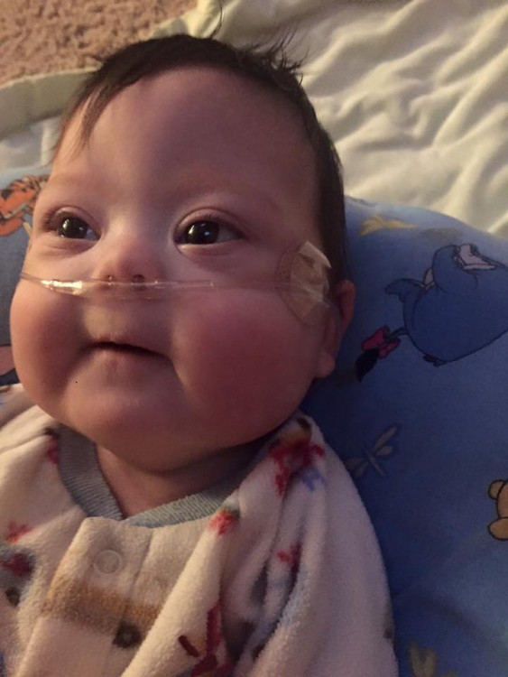 picture of baby with breathing tube