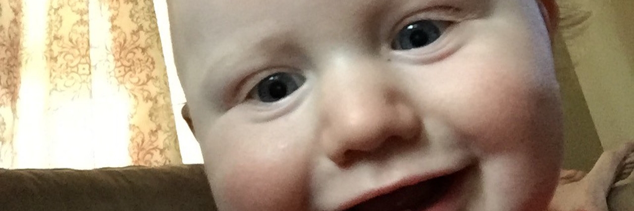 Thanking Doctors for Helping Young Boy With Cystic Fibrosis, MSUD close up of young boy smiling