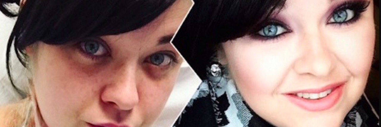 How to Accept Declining Health When Chronically Ill