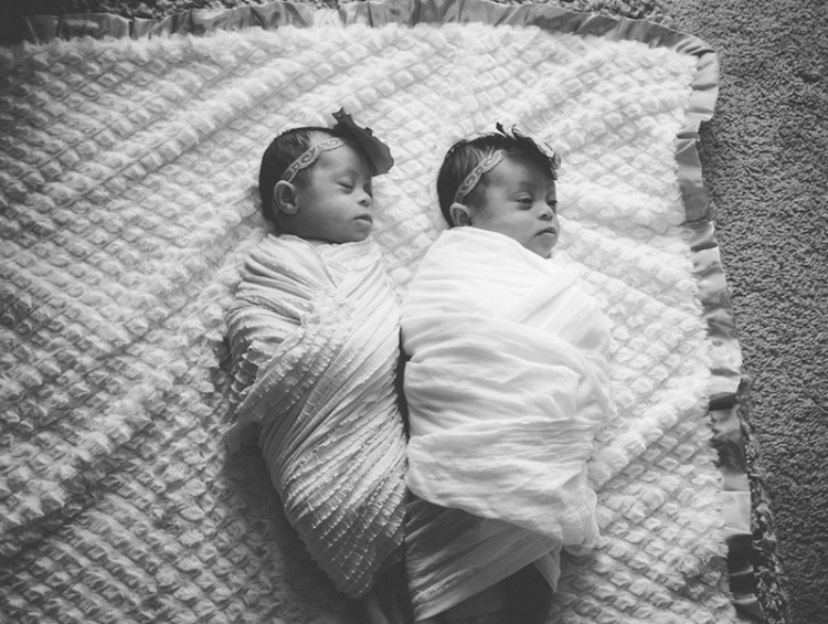 Black and white photo of the twins with Down syndrome laying on a blanket. 