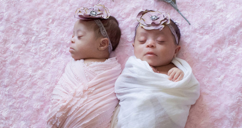 Photographer Captures Precious Images of Identical Twins With Down Syndrome