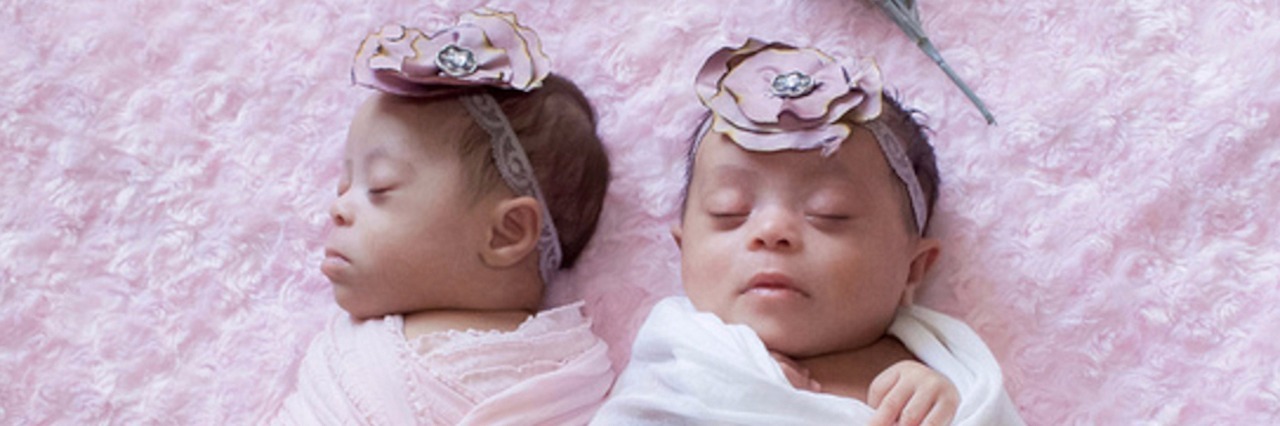 Laura Duggleby: Rare Photo of Twins With Down Syndrome photo of twins with down syndrome