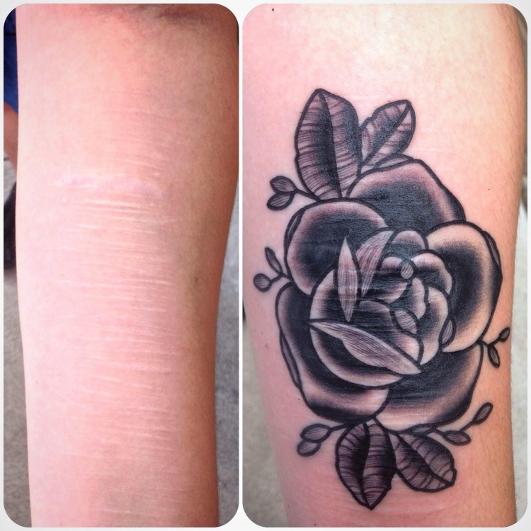 Maddie Keating's arms before and after her tattoo. On the left shows an arm with scars. On the right the scars are covered with a rose.