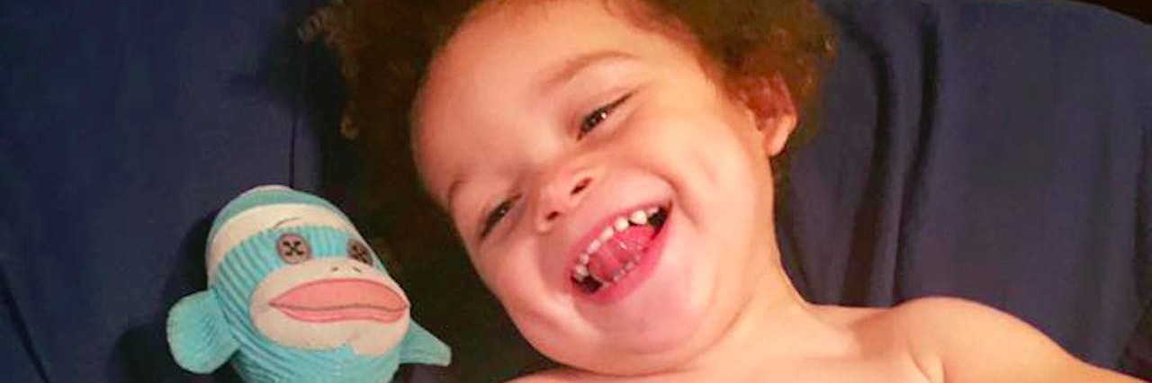 To the Woman at Walmart Who Called My Son's Stomas 'Repulsing'