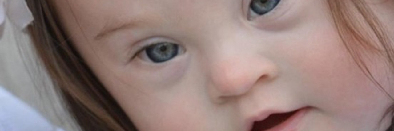 Doctor Not Supportive After a Down Syndrome Diagnosis Courtney’s daughter, Emersyn