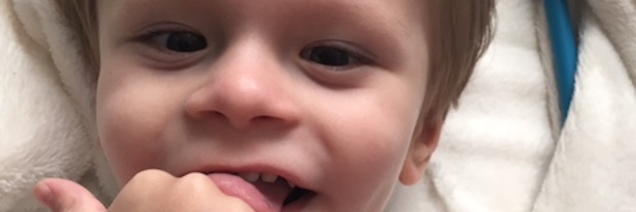 Choosing a Feeding Tube for Our Son With PMM2 CDG