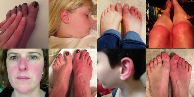 Photos of hands and feet and faces during EM flares