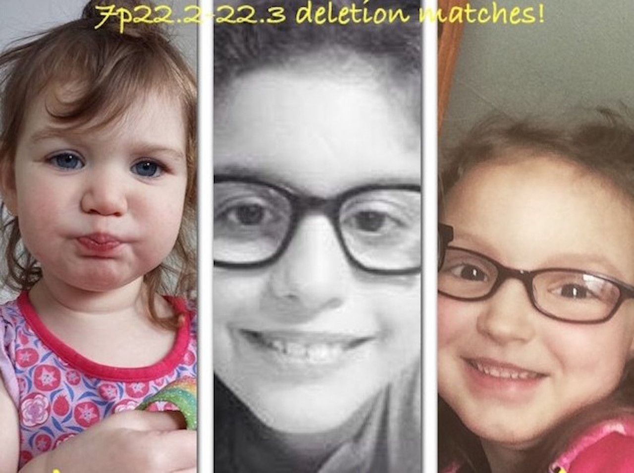 Rare Diseases Communities on Social Media