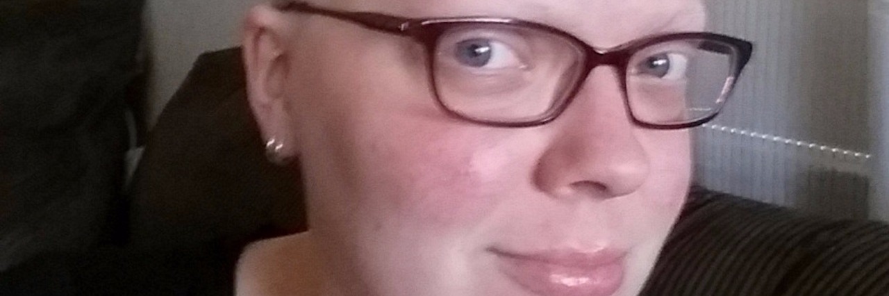 Chronic Illness and Employment: What I Look for in an Employer