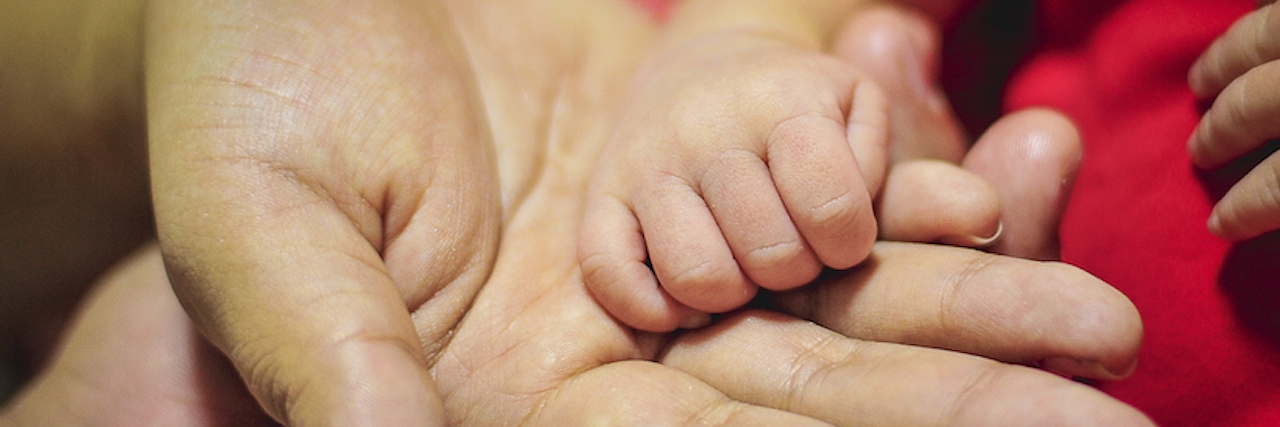 Cri du Chat Syndrome: Advice for Parents