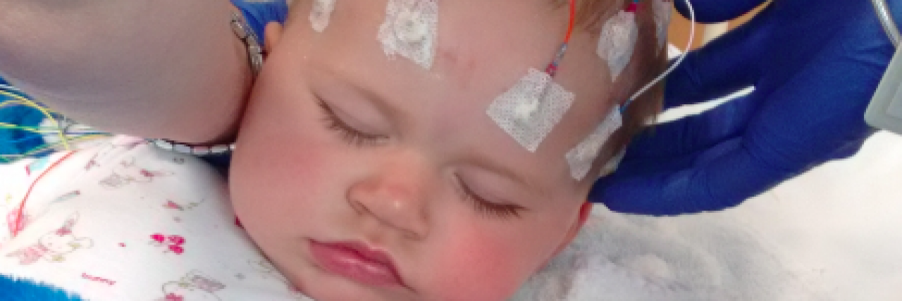 Contributor's young daughter, a baby, with EEG wires hooked up to her head and her eyes closed