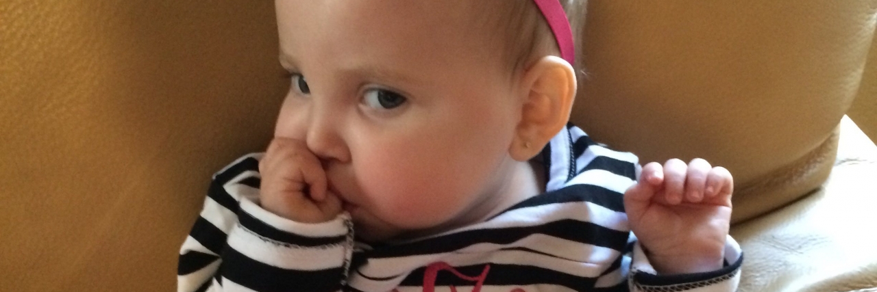 CDKL5 Genetic Disorder: What I Wish I Knew When My Child Was Diagnosed baby wearing striped onesie sucking her thumb