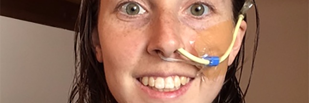 To the Doctor Who Didn't Believe I Had Gastroparesis Kylene with her NJ tube.