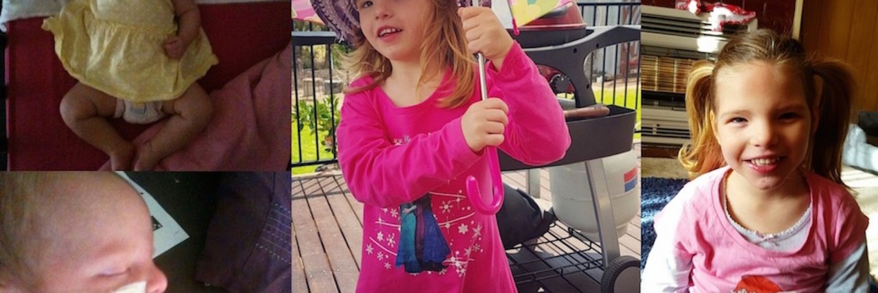 Mother Raises Awareness for Cri du Chat Syndrome Ella