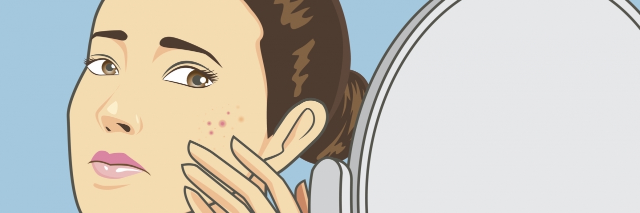 When Picking at Your Skin Is More Than a Bad Habit Women strain at back cosmetic mirror with problem acne face.