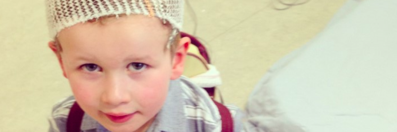 What It's Like When Your Child Has Epilepsy Young boy with mesh covering his hair and wires attached to head