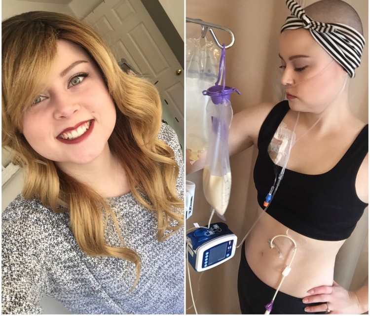 photo of woman looking healthy next to photo of her wearing medical devices