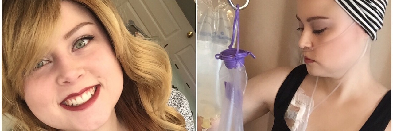 Common Mistakes About Invisible Disabilities and Accessibility