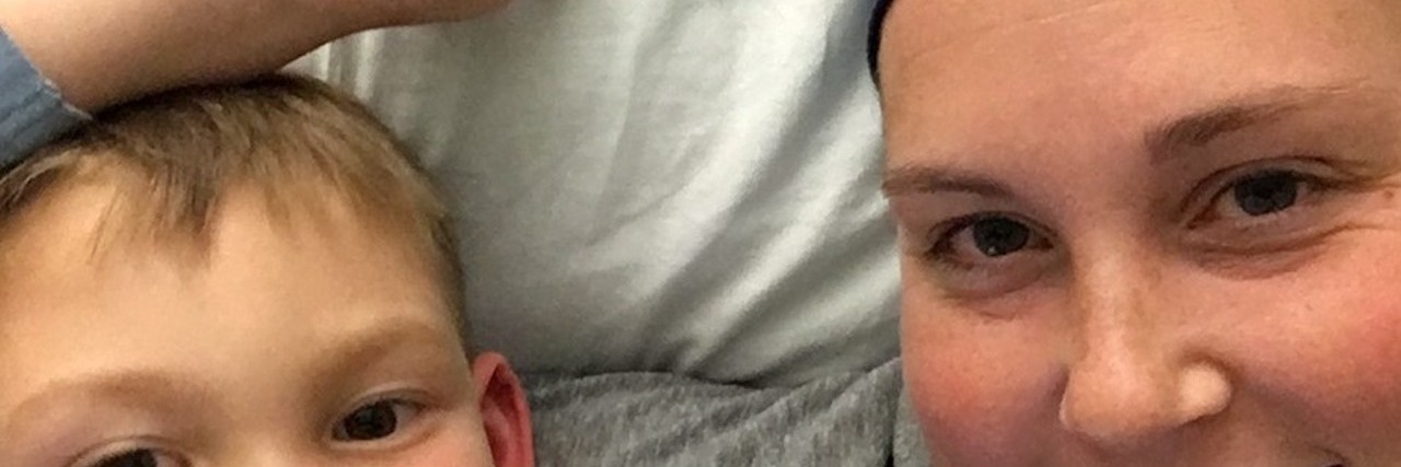 The Beginning of My Journey With My Son’s Rare McCune-Albright Diagnosis