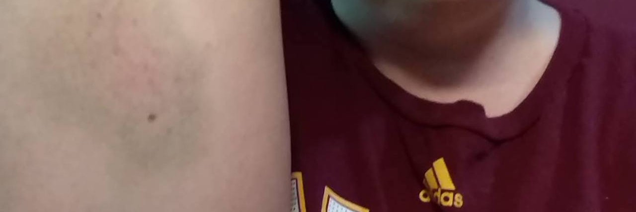 Special Needs Mom With Mental Health Problems Thanks Cleveland Cavs woman in cavs shirt holding up arm