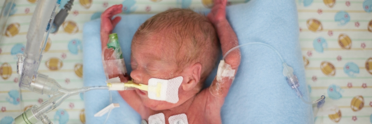 Letter to Parents Whose Child Has Just Died baby peyton in the nicu