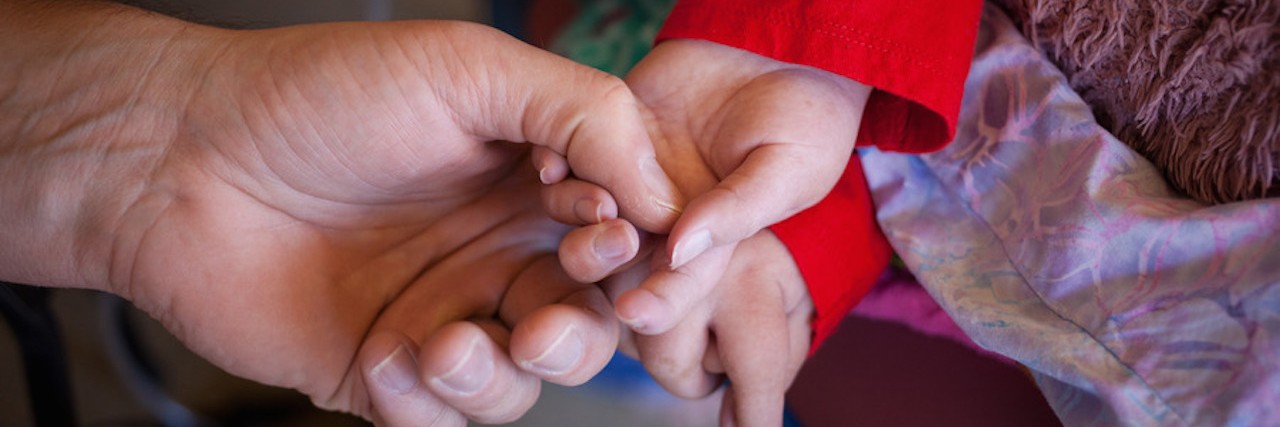 How Hospice and Palliative Care Improved Our Daughter's Quality of Life AUSTIN, TEXAS - Tim Barnes holds his daughter's hand on Christmas day. Casey, 8, has a number of primary issues including HIE (Hypoxic Ischemic Encephalopathy); Quadriplegia Cerebral Palsy; and a host of respiratory problems. In addition to CP, Casey is missing basic reflexes --- she is unable to suck, swallow, gag or blink. Without the ability to swallow, Casey's airway is in constant risk. Suction equipment is needed to remove secretions and anything else in her mouth/throat in order for her to breathe. Also, without the ability to swallow Casey cannot eat by mouth and is fed with a G-Tube.