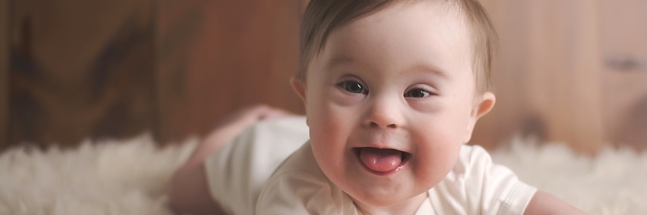 Meagan Nash Writes How Her Son With Down Syndrome's Story Went Viral asher at 8 months