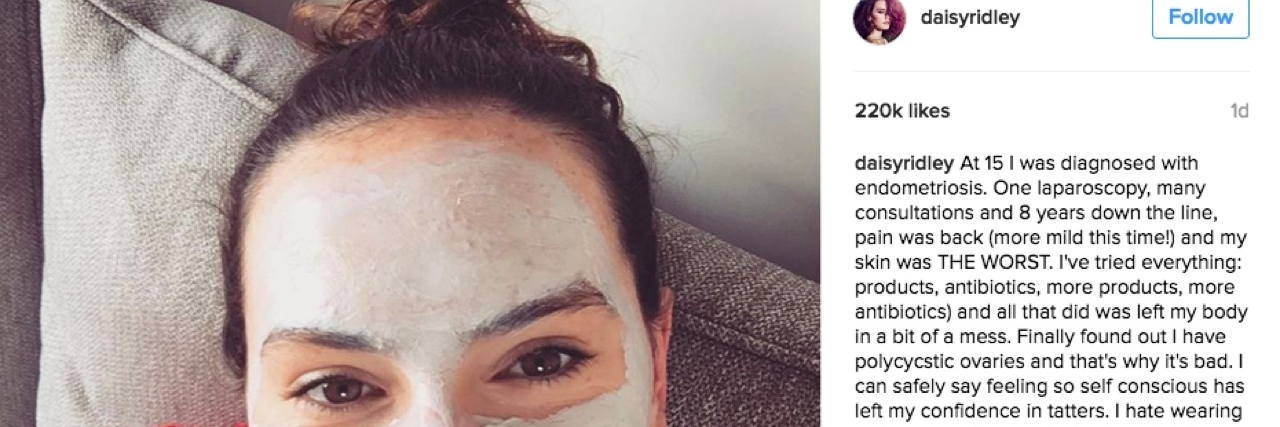 Response to Daisy Ridley's Instagram Post About Endometriosis Daisy Ridley's Instagram Post