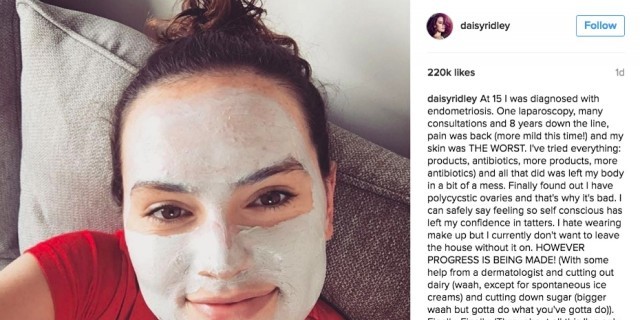 Dear Daisy Ridley, Thanks for Raising Endometriosis Awareness, But… Daisy Ridley's Instagram Post