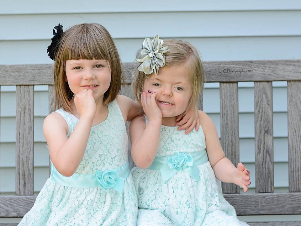 little girls with apert syndrome