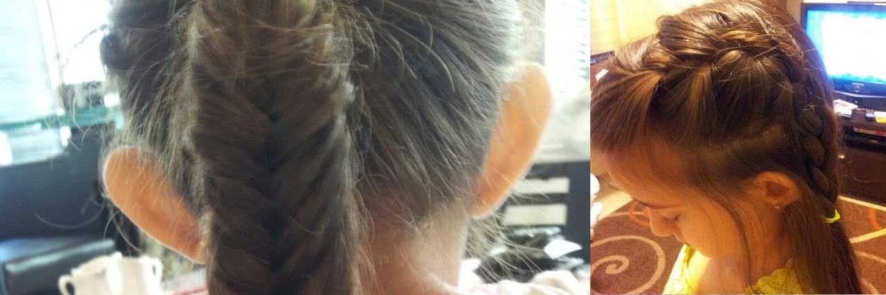 Young Girl With Erythromelalgia Decides to Donate Hair Lynn showing off her hairstyles