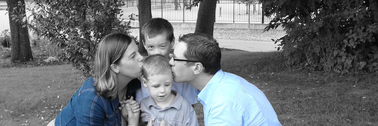 Redefining Brave After Son Was Diagnosed With Craniosynostosis Kathy and her family